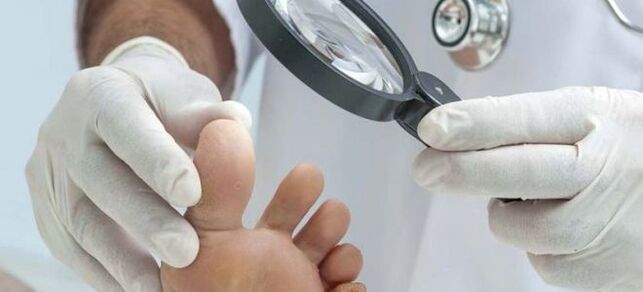 Badania przed rozpoczęciem leczenia grzybiczego