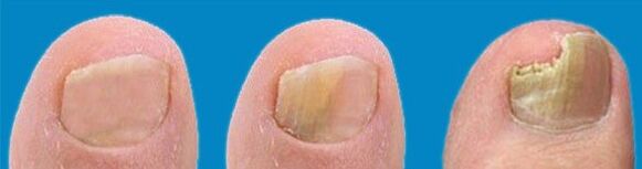 Proces rozwoju grzybów