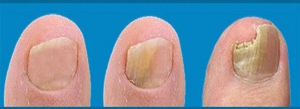 proces rozwoju grzybów